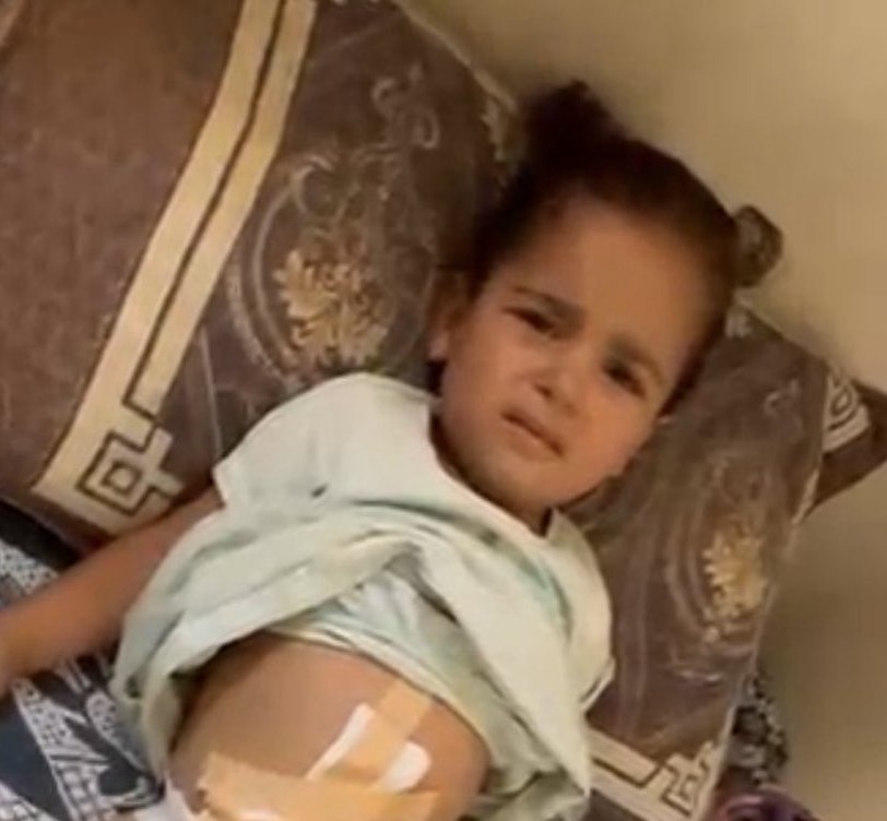 A young child resting after treatment.